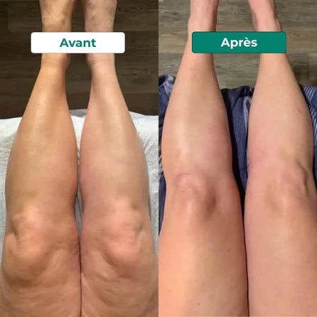 Avant après 3